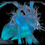 Esame TAC coronarica 256 slice Studio Radiologico Viterbo Castellana Grotte Bari