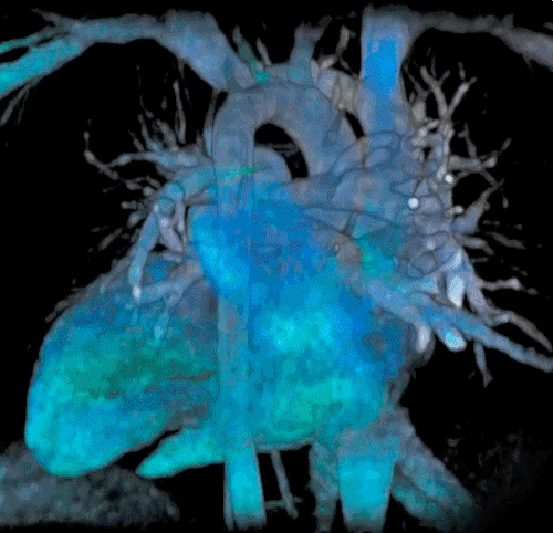 Esame TAC coronarica 256 slice Studio Radiologico Viterbo Castellana Grotte Bari