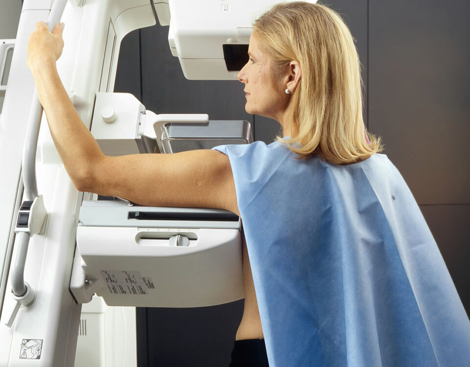 Mammografo Hologic 3Dimensions con tecnologia Genius AI Detection — Studio Radiologico Viterbo Castellana Grotte