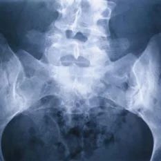 radiologia digitale bacino