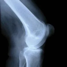 radiologia digitale ginocchio