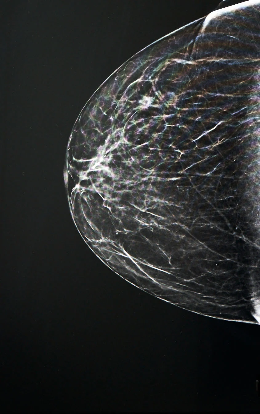 screening mammografico - dettaglio formazione seno