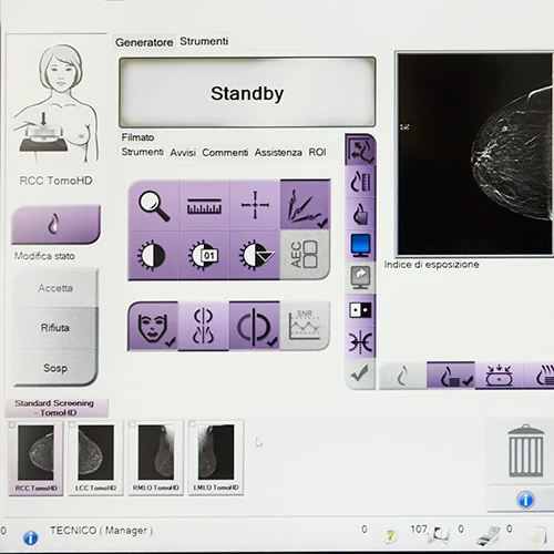 screening mammografico immagini software