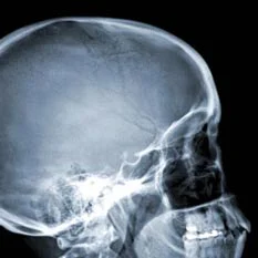 radiologia digitale cranio