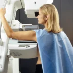 Mammografo Hologic 3Dimensions con Intelligenza Artificiale Studio Viterbo Bari