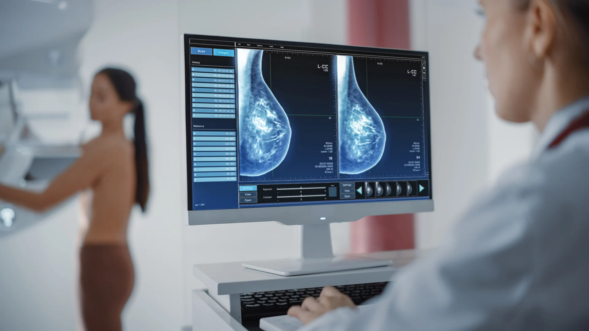 Mammografia digitale 3D con tomosintesi