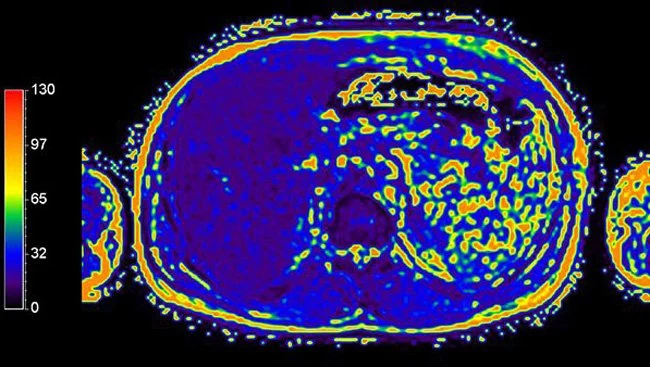 risonanza magnetica, immagini di un esame