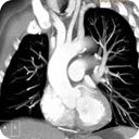 TAC Philips 256 slice Studio Radiologico Viterbo Castellana Grotte Bari